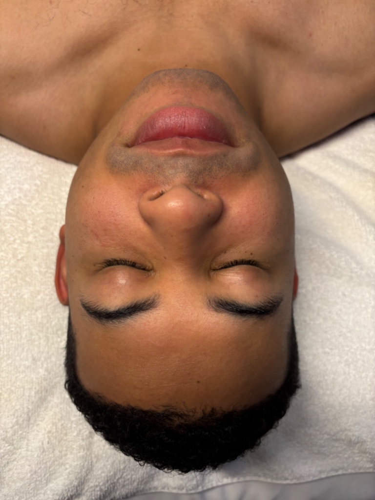Signature Glow Facial before
