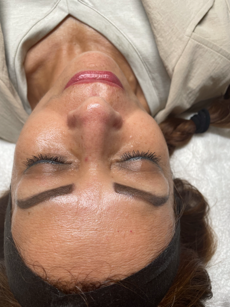 Intensive Hydration Facial after