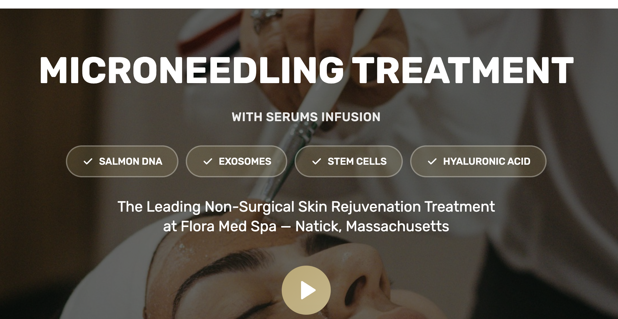 Microneedling Treatment template preview