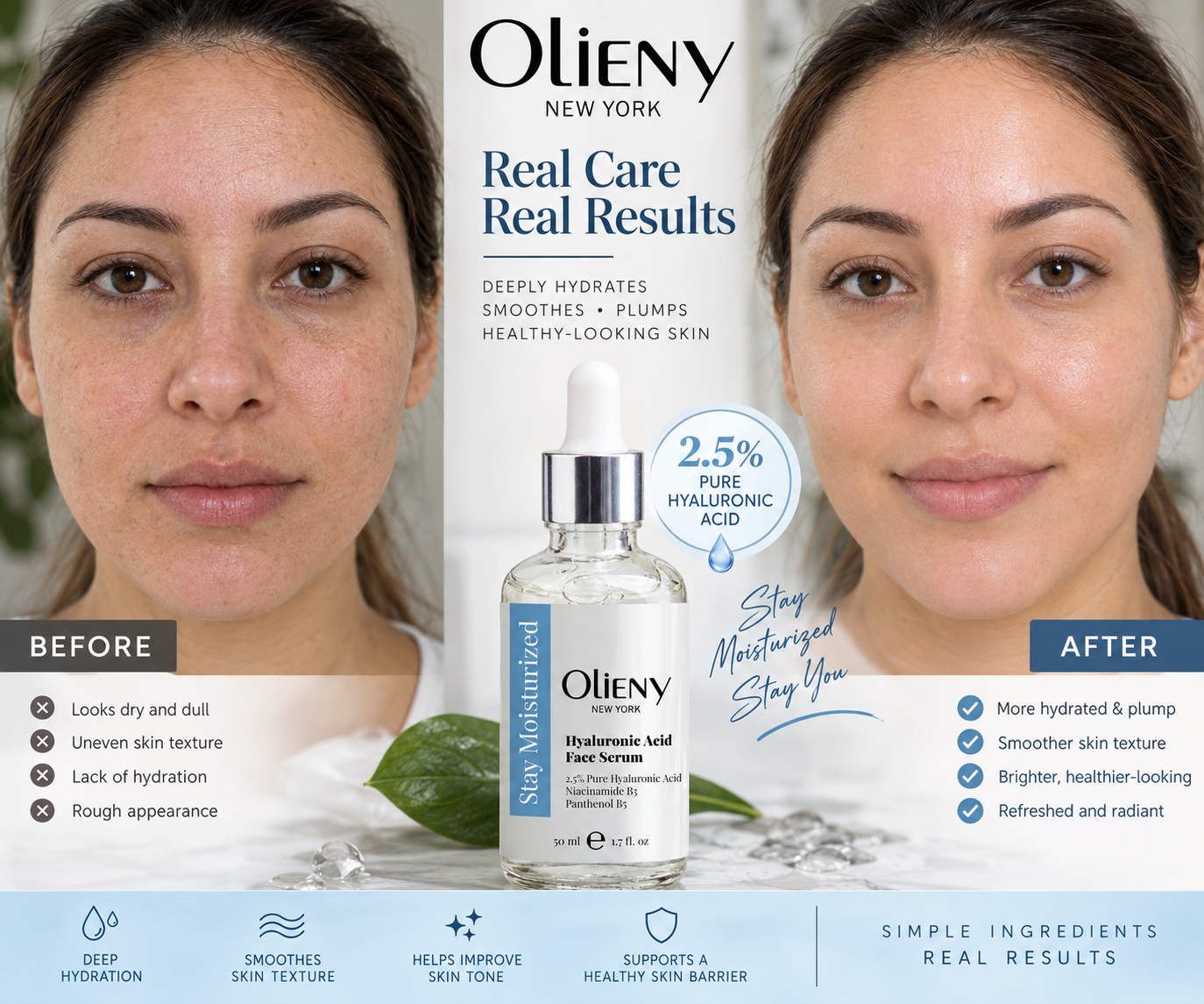 Stay Moisturized Hyaluronic Acid