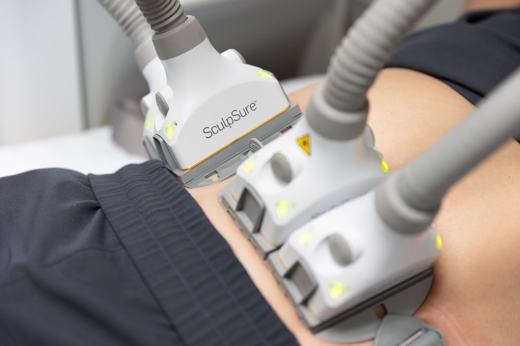 SculpSure