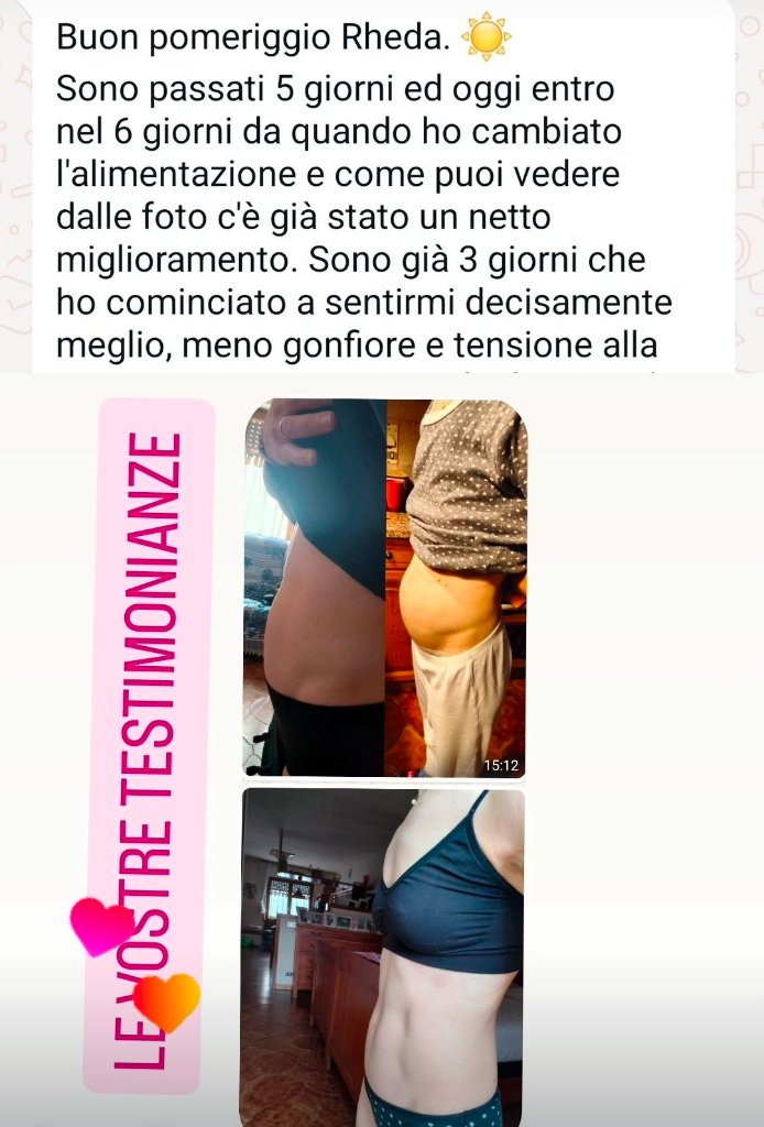Dopo