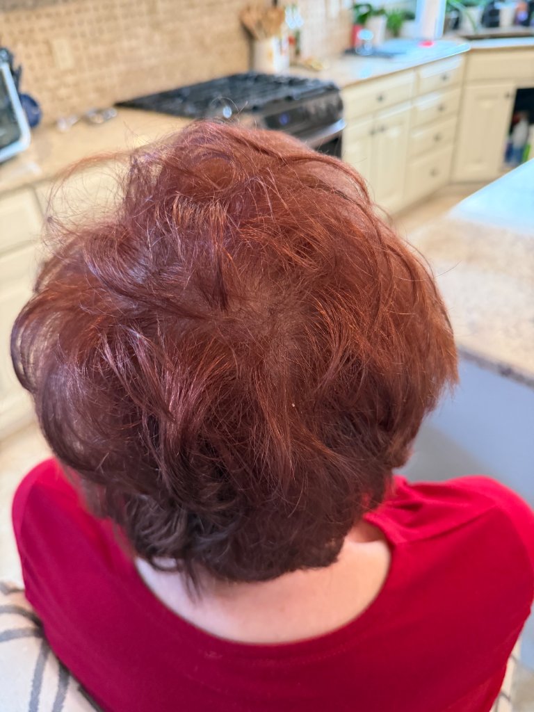 Arlene's hair before her custom topper