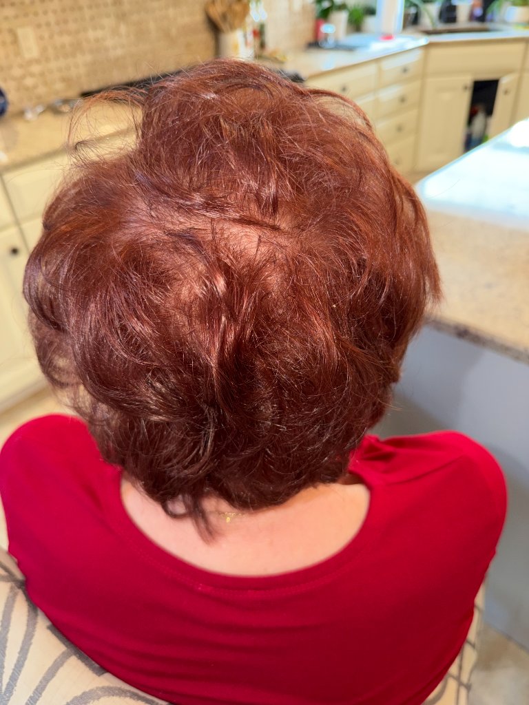 Arlene's hair before her custom topper