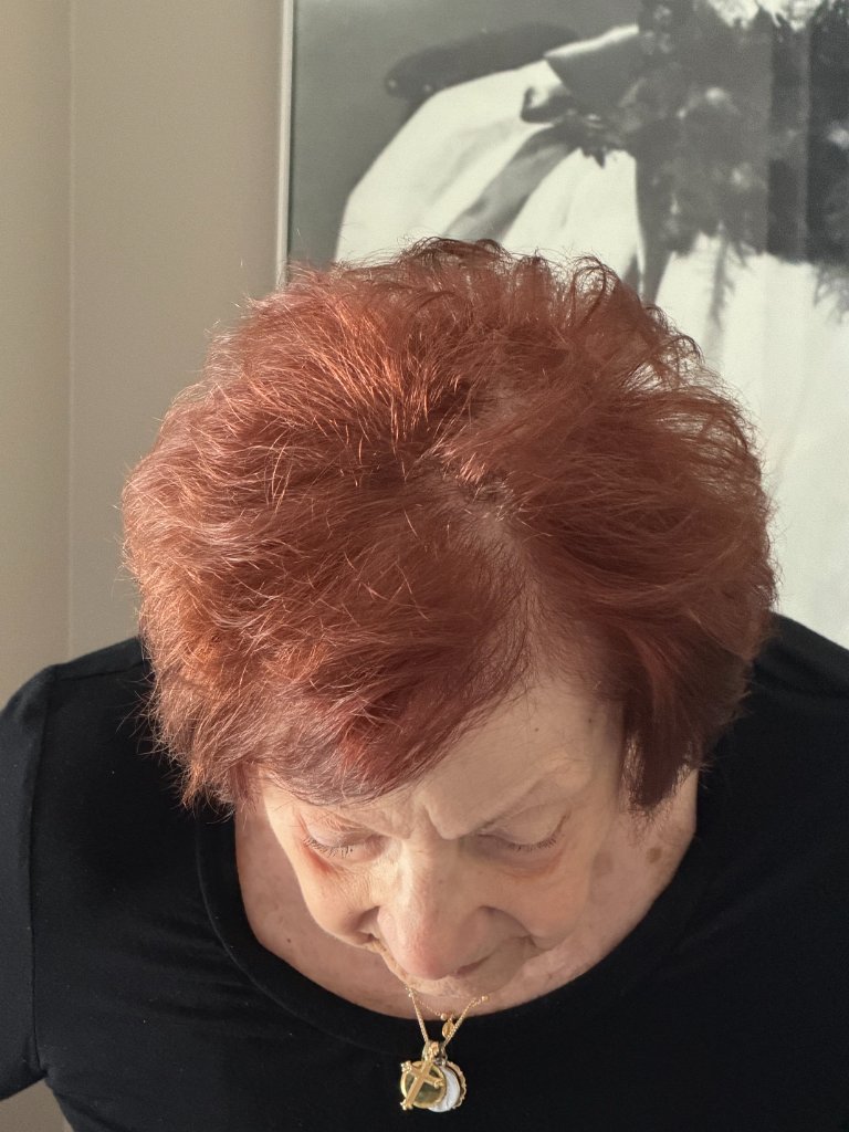 Arlene's hair before her custom topper