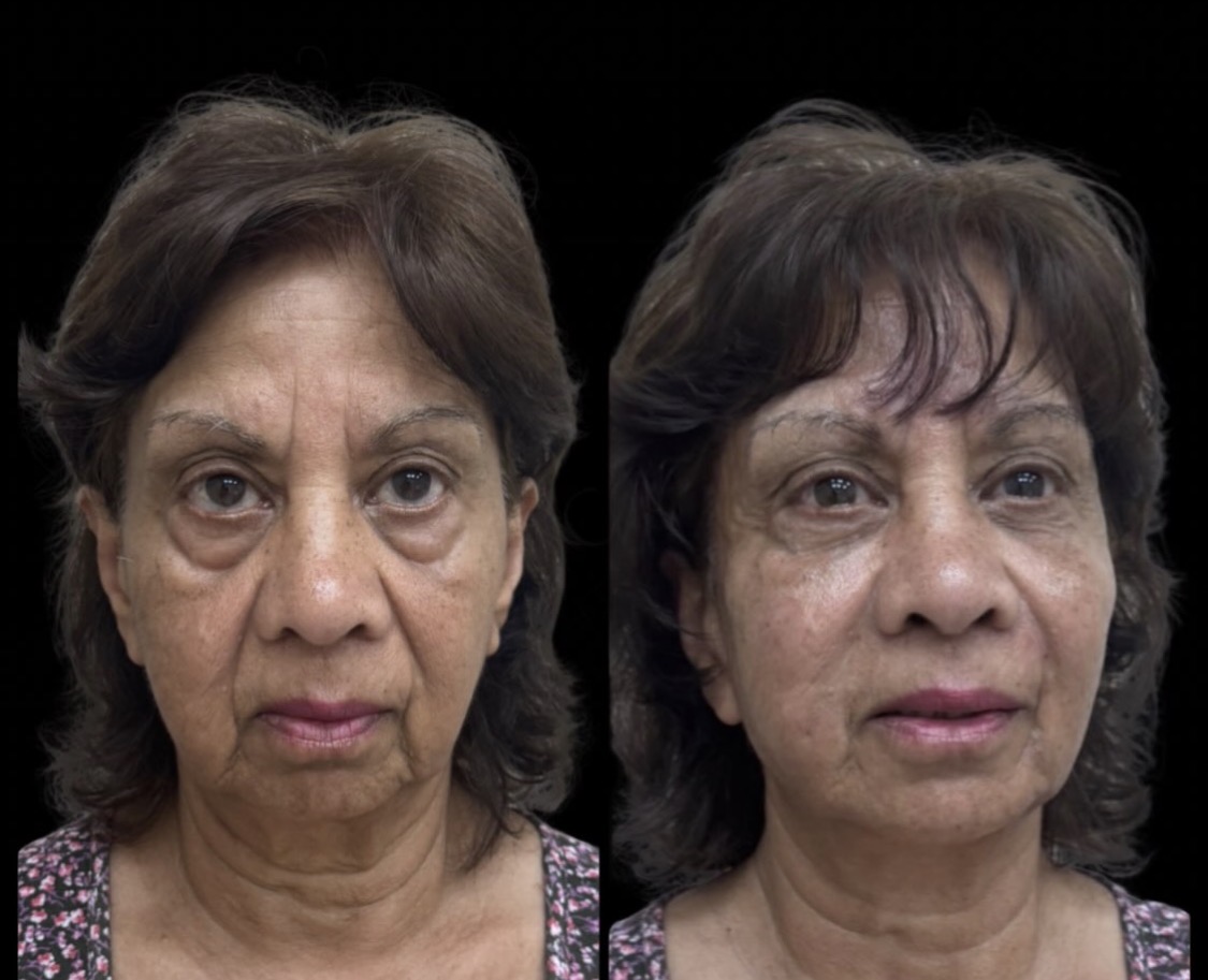 Injectables gallery 8