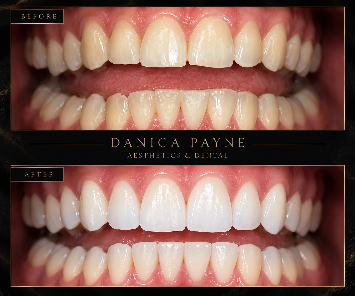 Before and after cosmetic and general dental treatment at Danica Payne Aesthetics & Dental