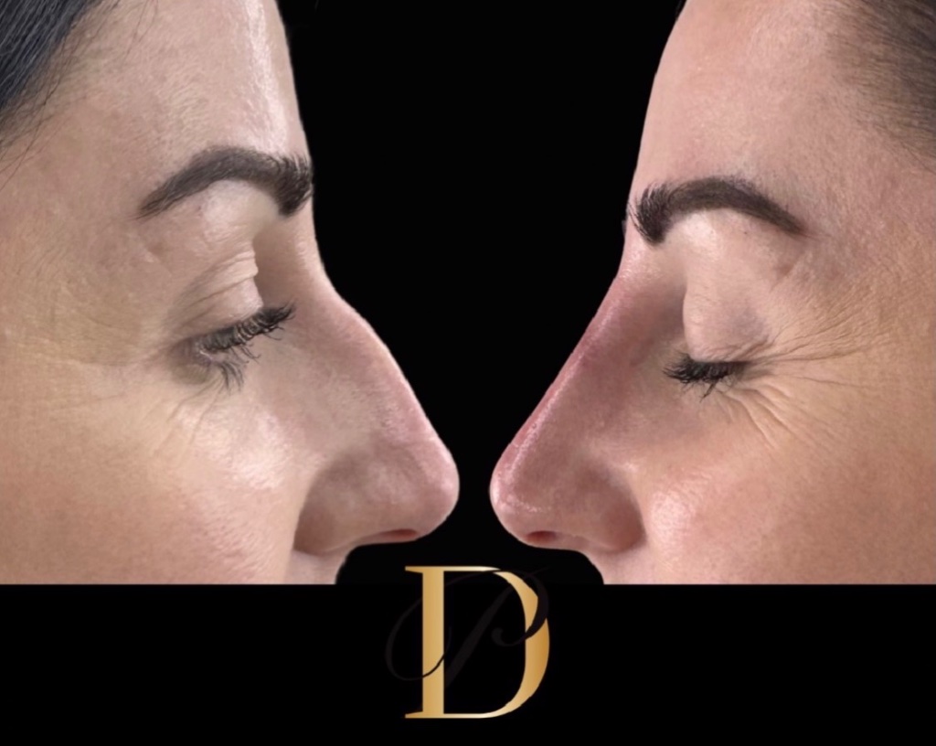 Injectables gallery 7