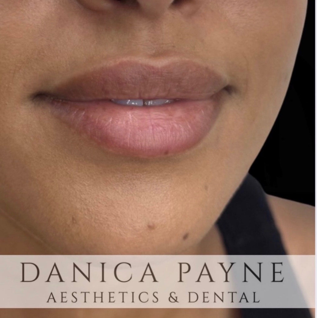 Injectables gallery 5
