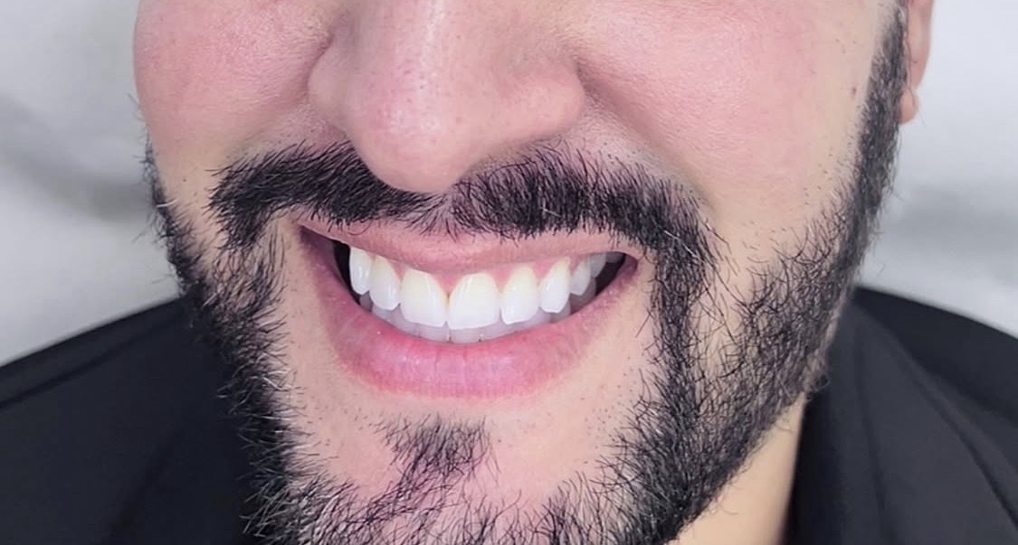 Smiling patient after professional tooth whitening at Danica Payne Aesthetics & Dental