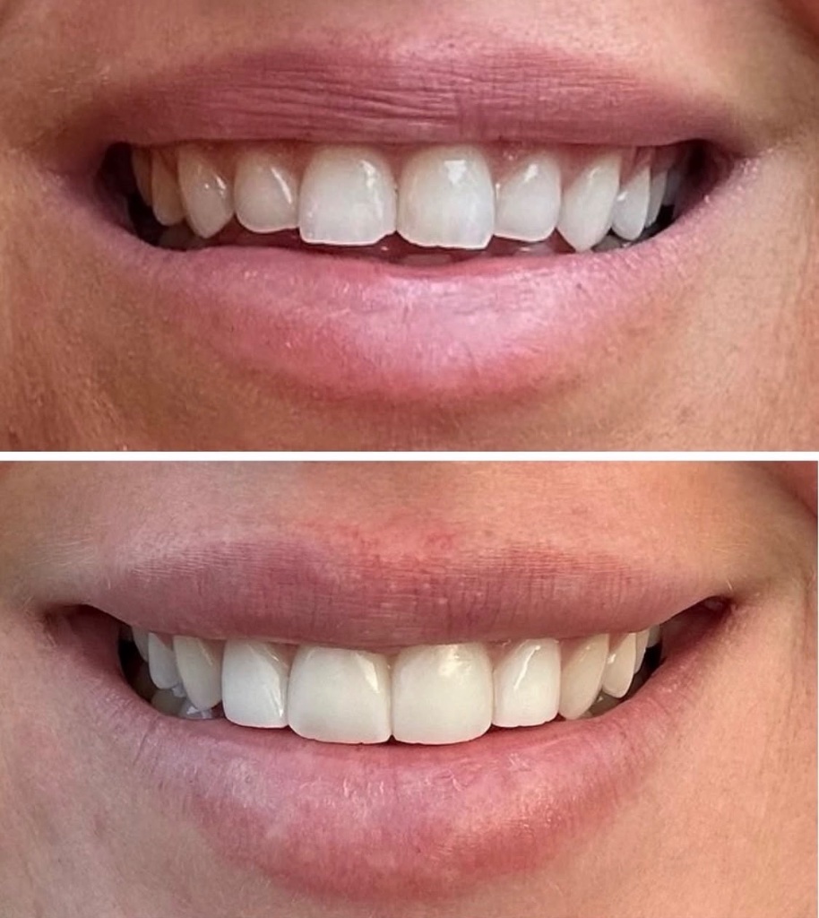 Injectables gallery 2