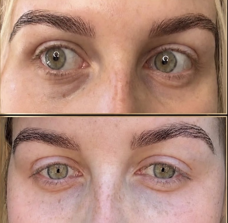 Injectables gallery 4
