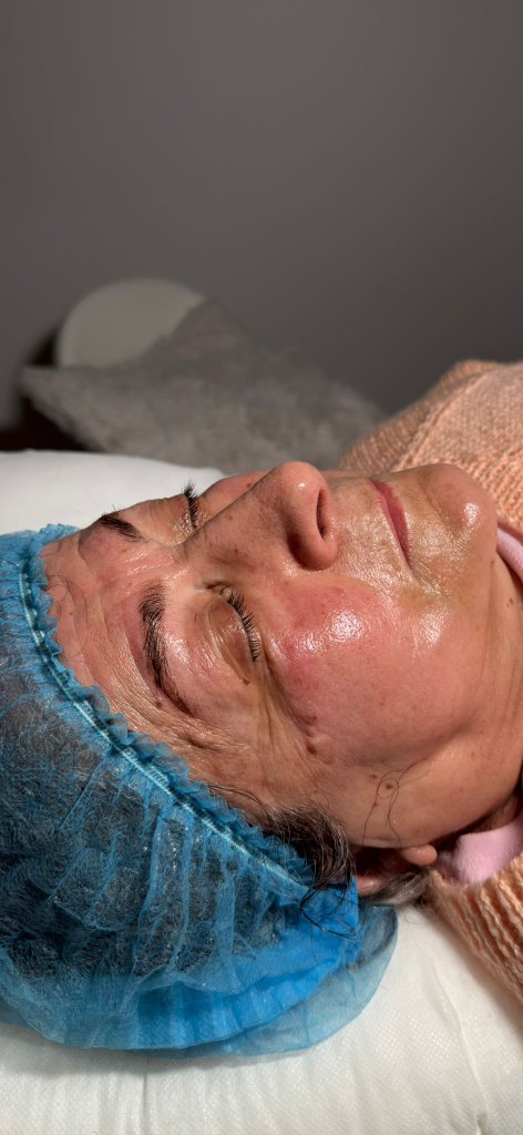 Skin Rituals