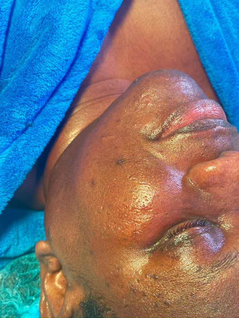 Skin Ritual Facial after