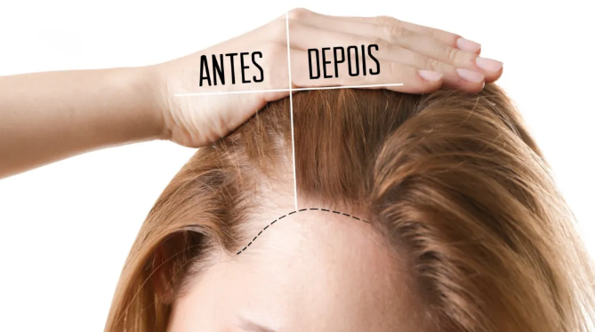 Resultado antes e depois