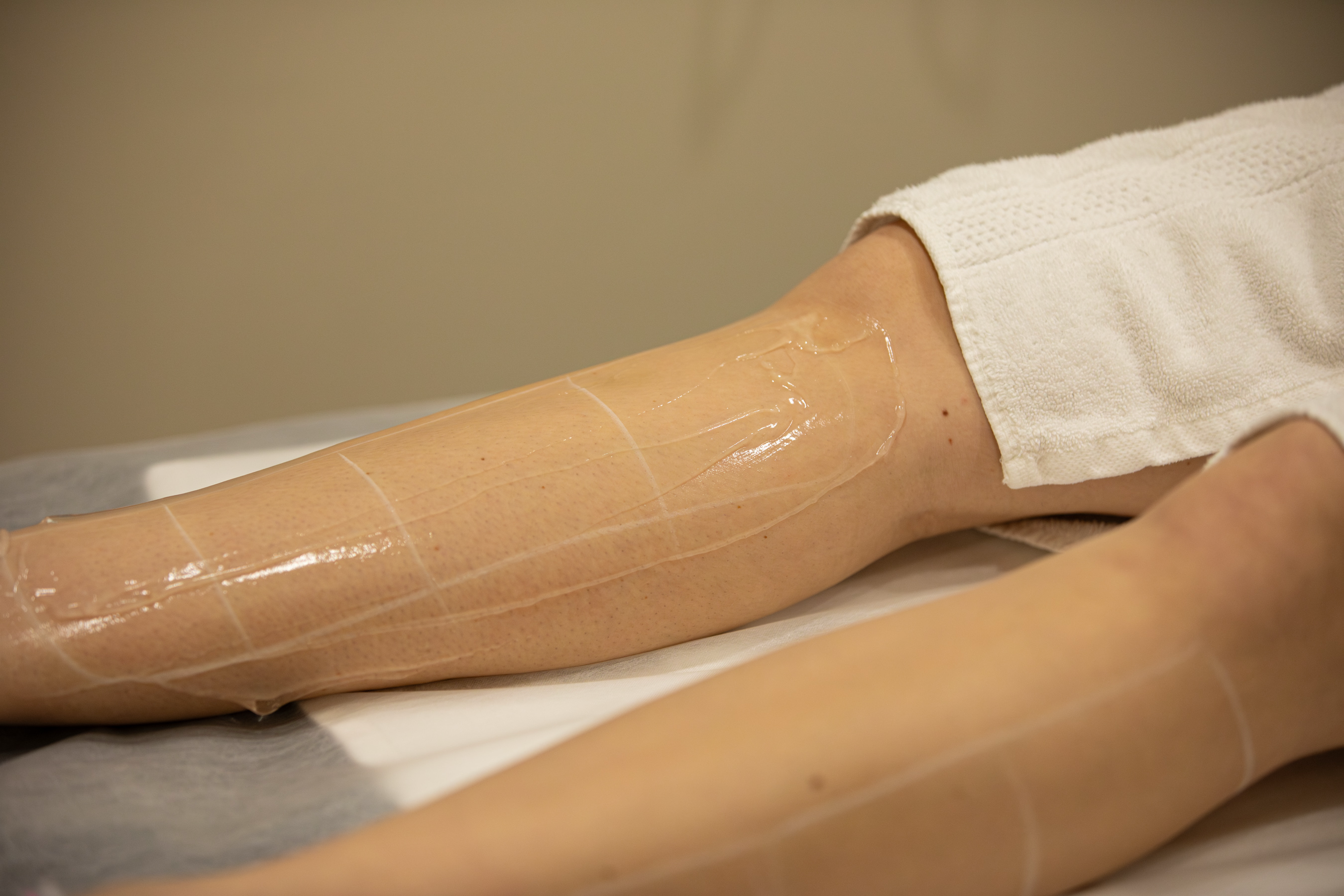 Laser Hair Removal at Bella's Studio