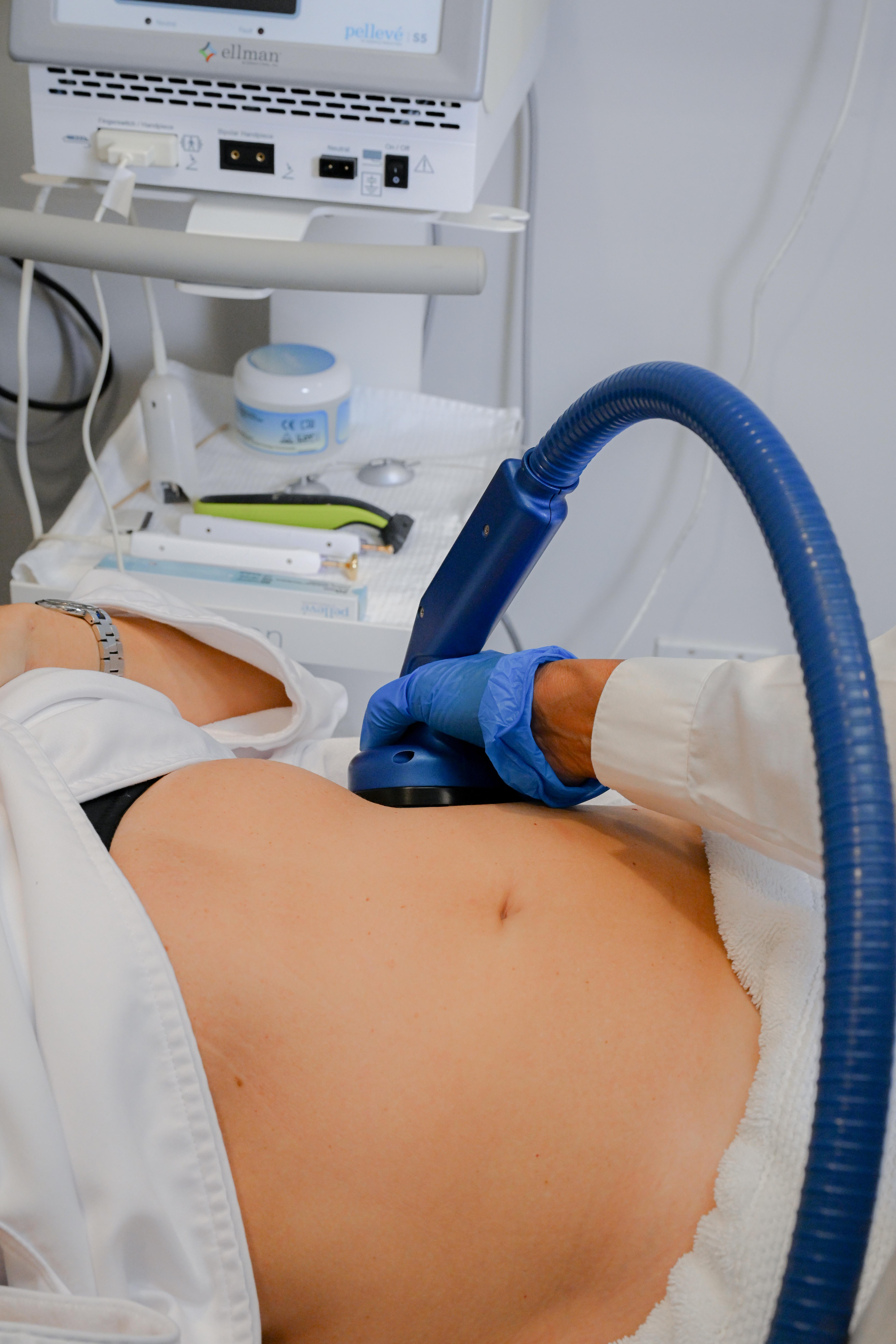 Pellevé Radiofrequency System at Highstyle Laser Center in Boston