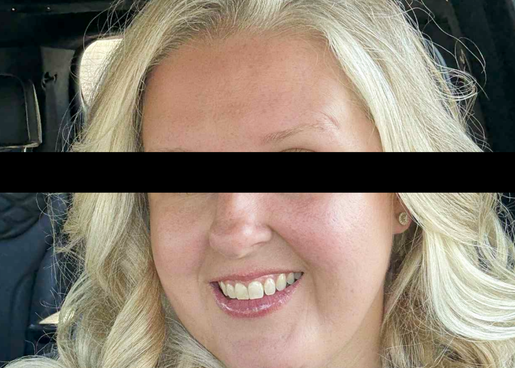 After treatment