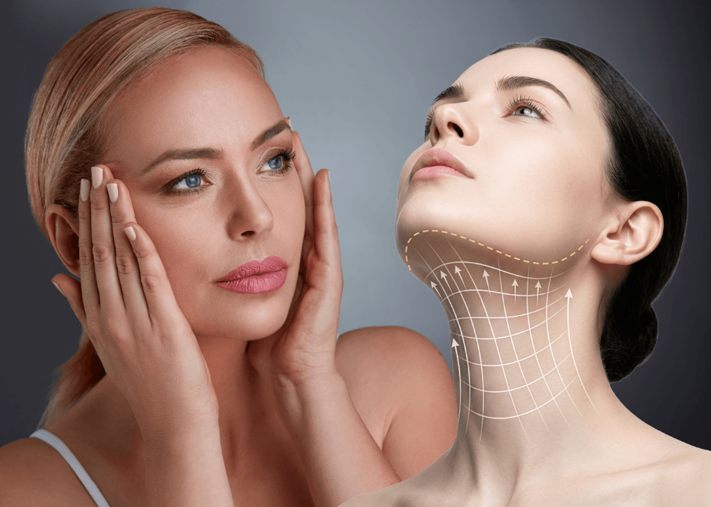 Wrinkle Treatment