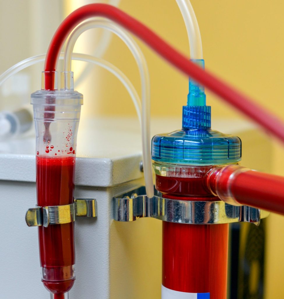 EBOO Ozone Therapy