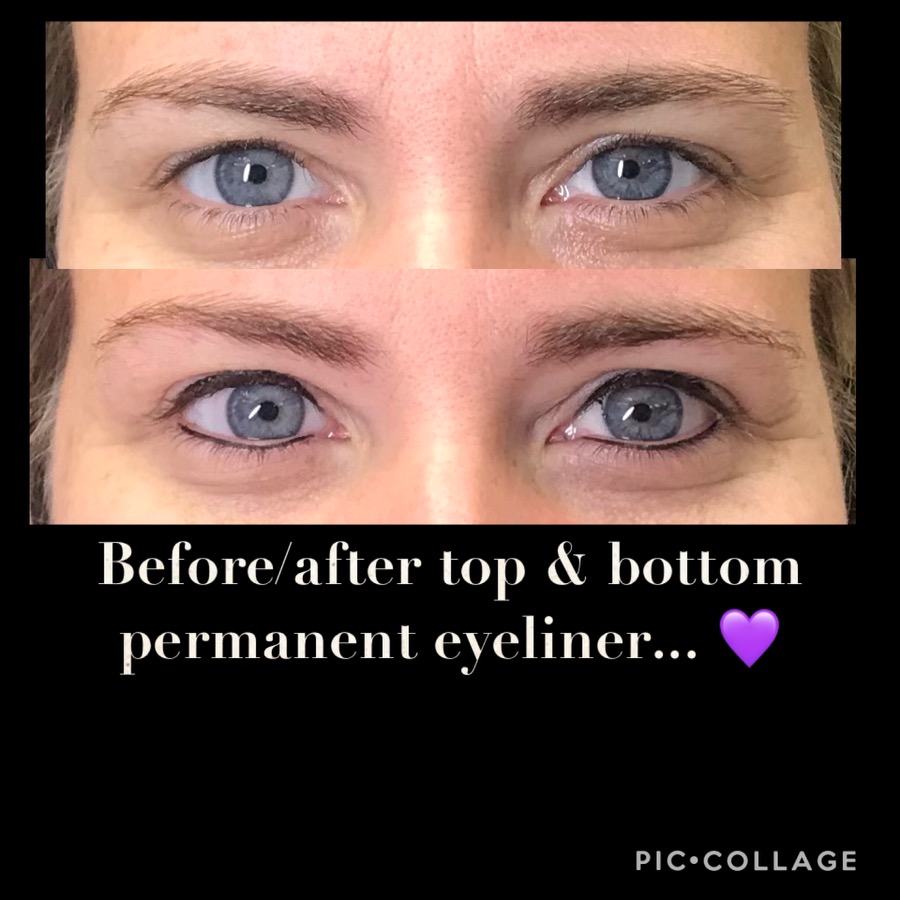 Top & Bottom Liner