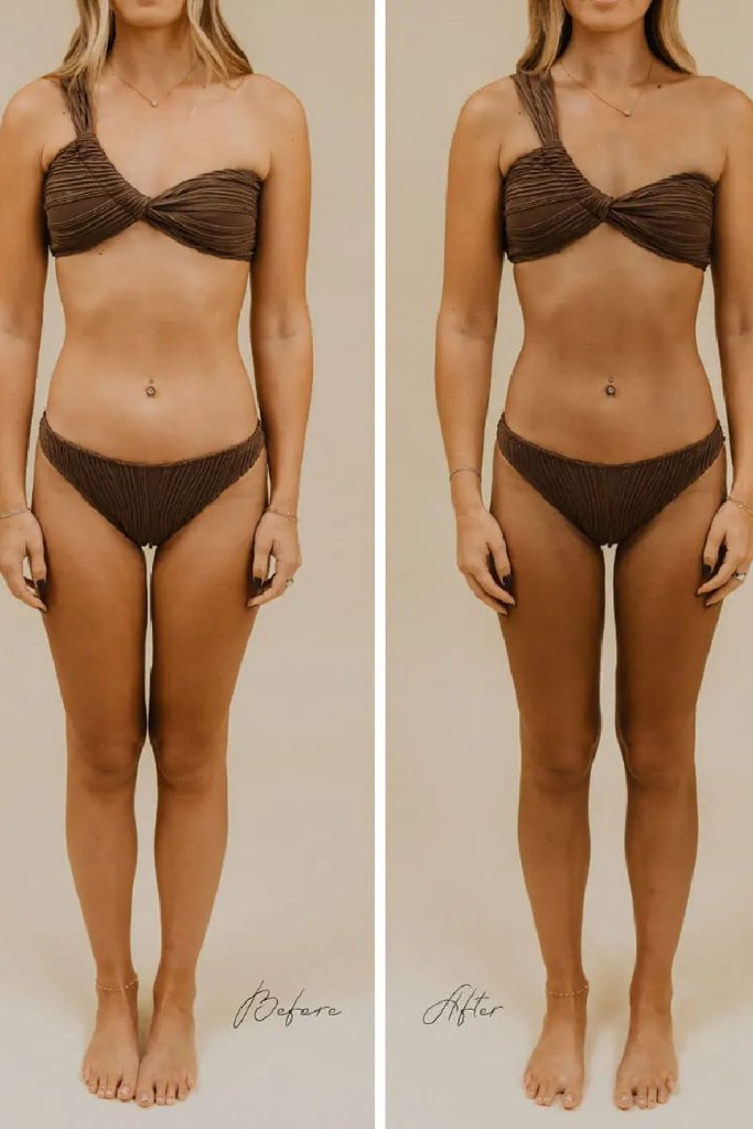 Before & After