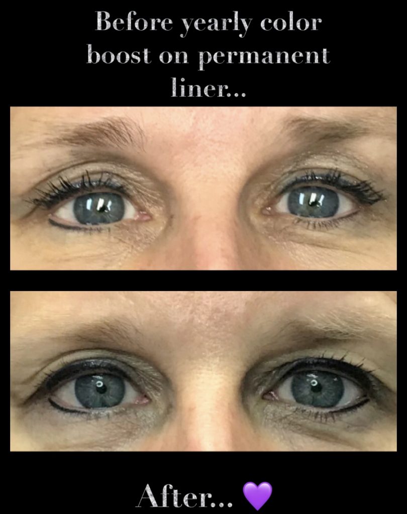 Color boost on 3 year old liner