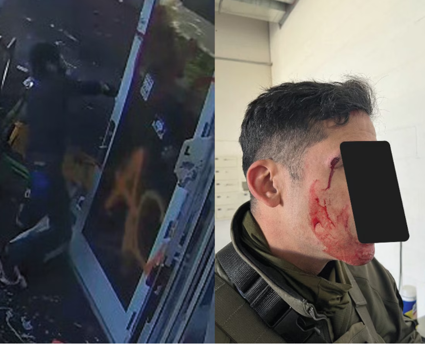 Surveillance footage and officer injury