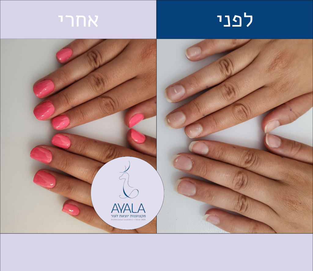 מניקור — לפני ואחרי