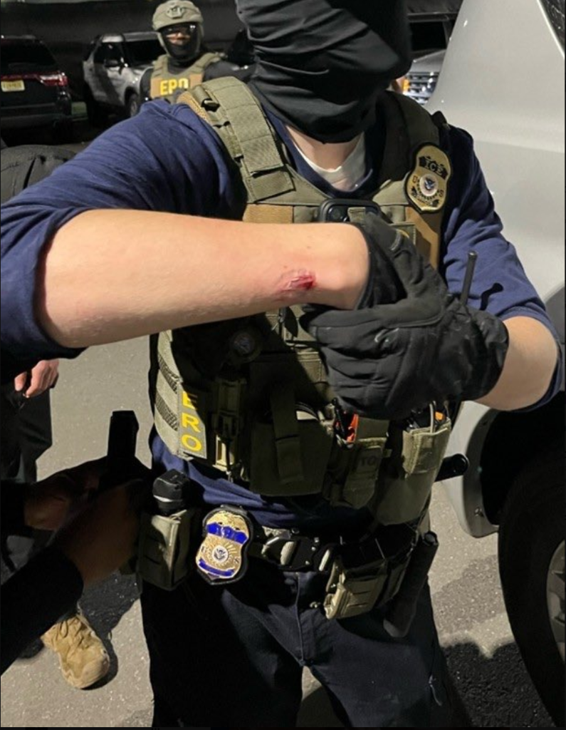 ICE Officer — Victim-1 Forearm Injury