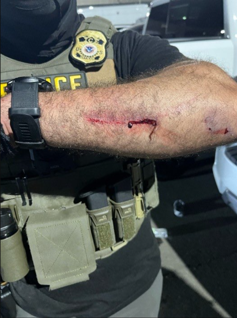 ICE Officer — Victim-2 Bite Wound on Forearm