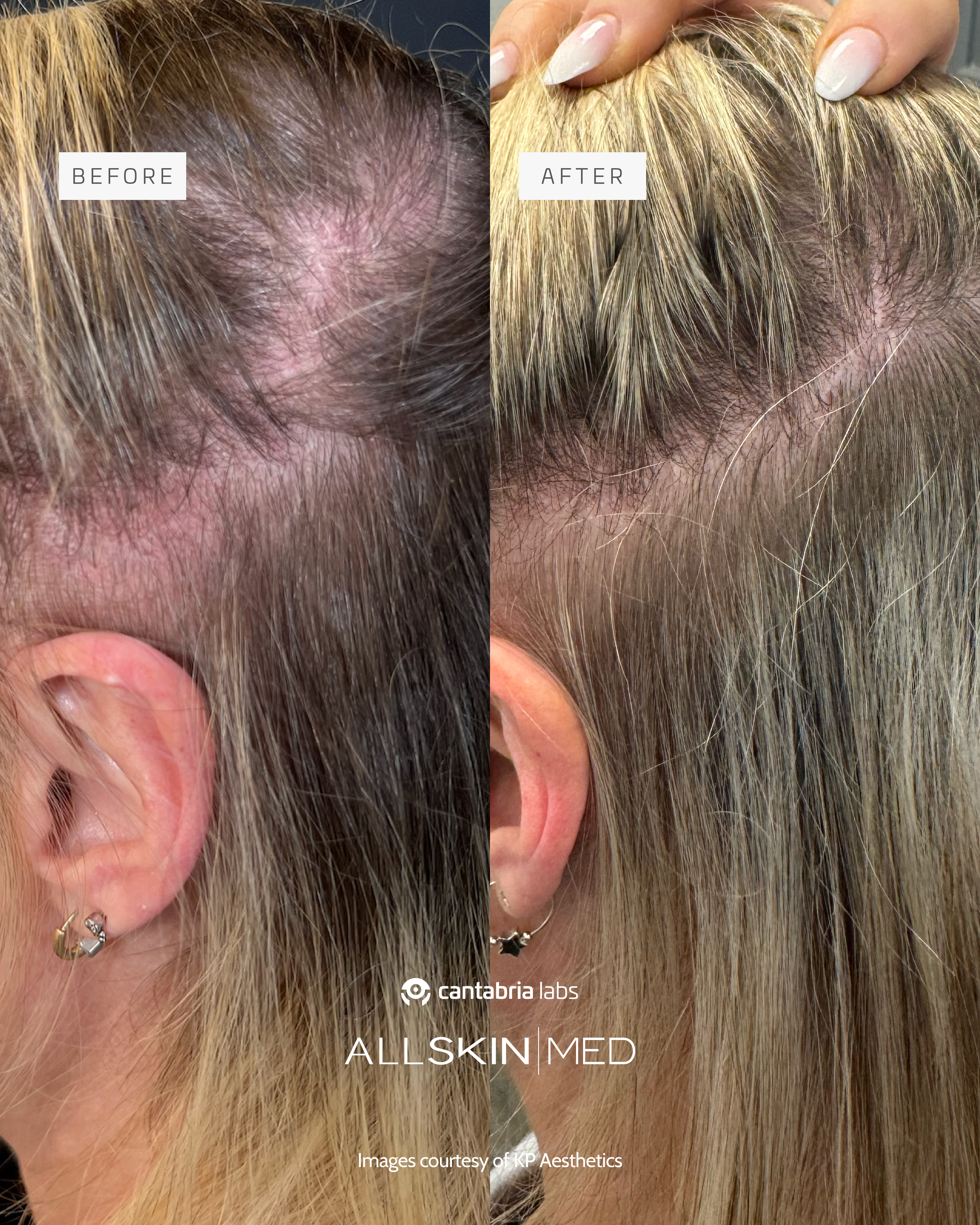 Before and after treatment comparison
