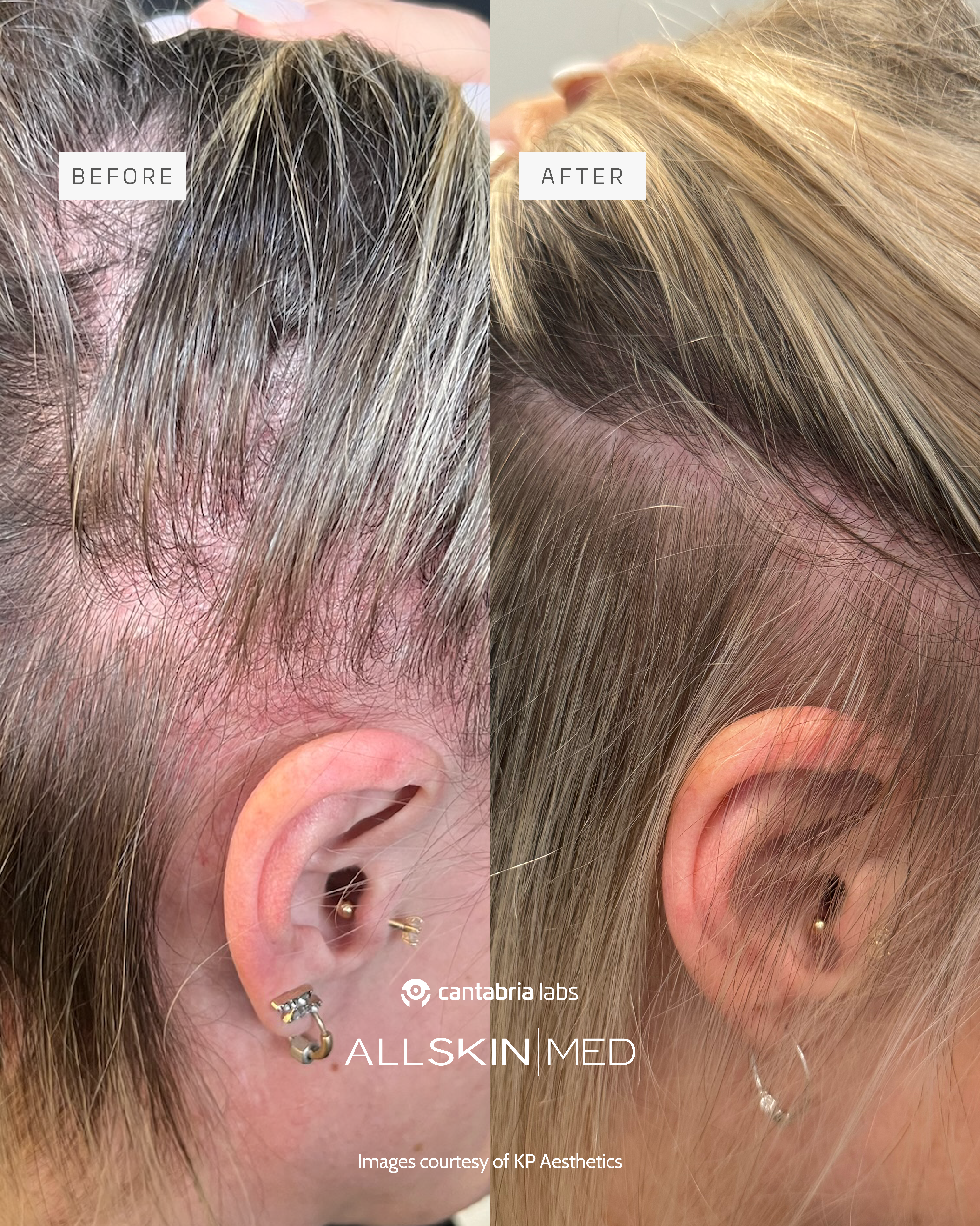 Before and after treatment comparison