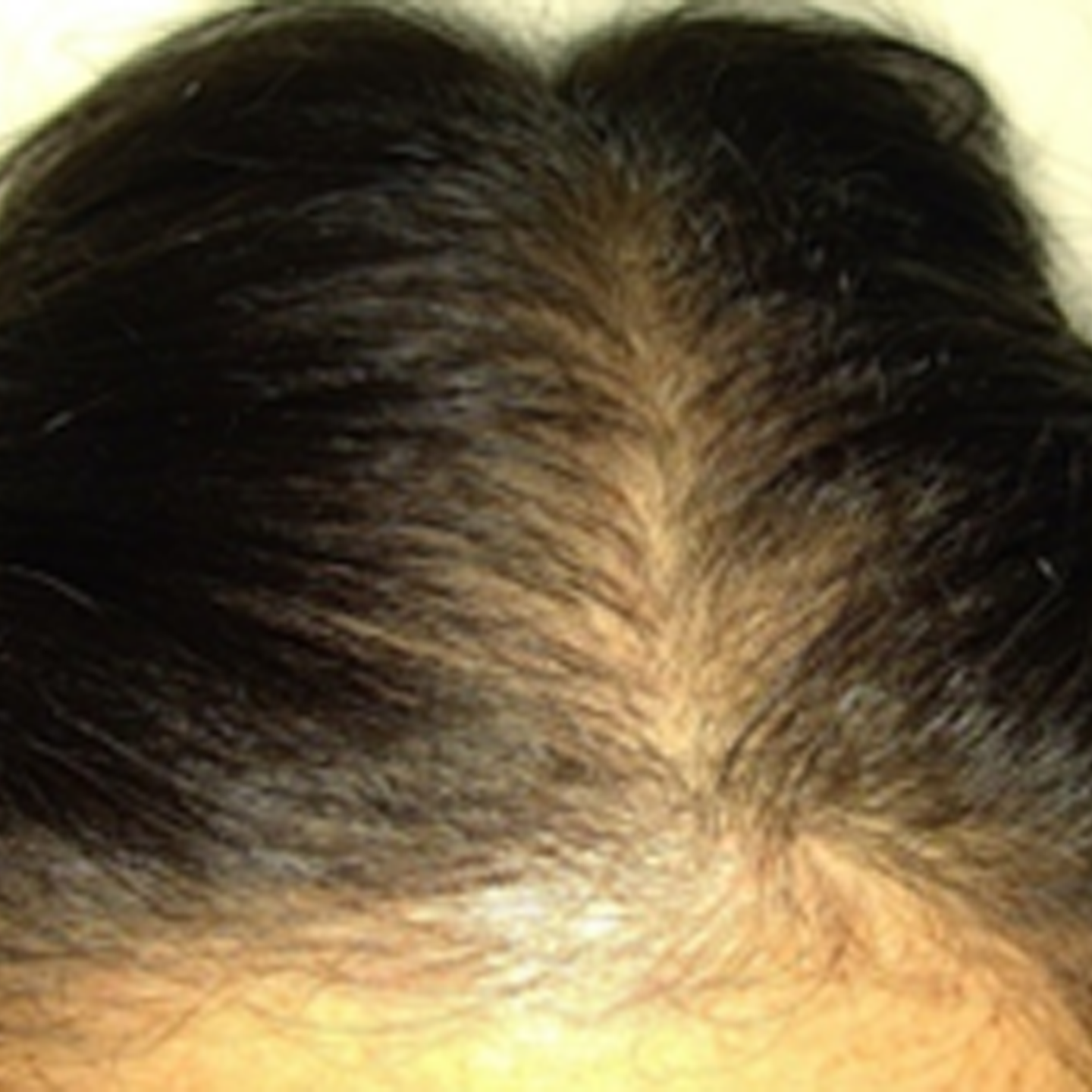 Before treatment