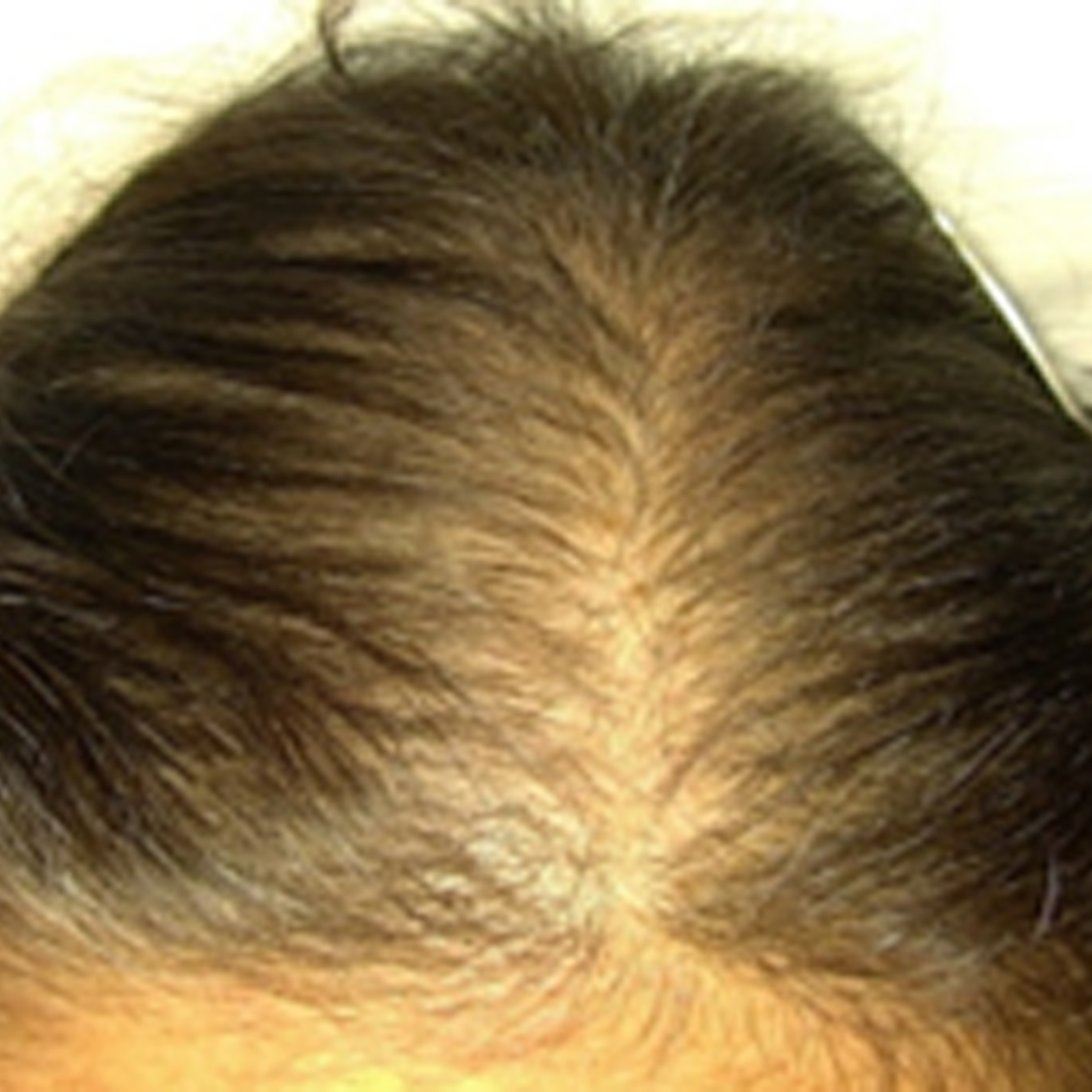 Before treatment