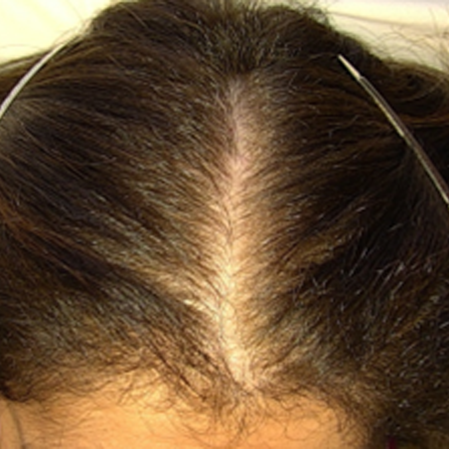 After treatment