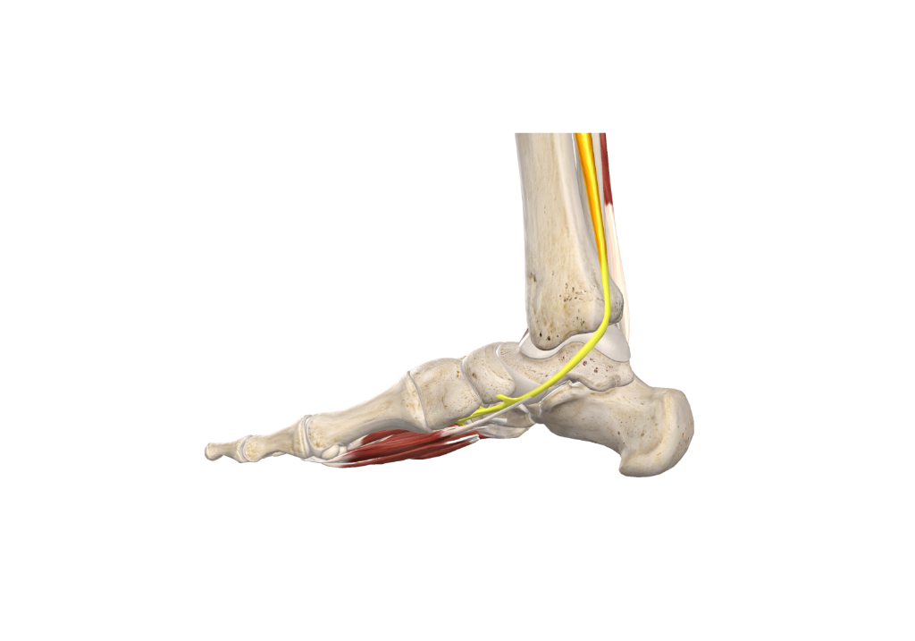 Tibialis Posterior Tendon Dysfunction (PTTD) / Adult Acquired Flat Foot Deformity