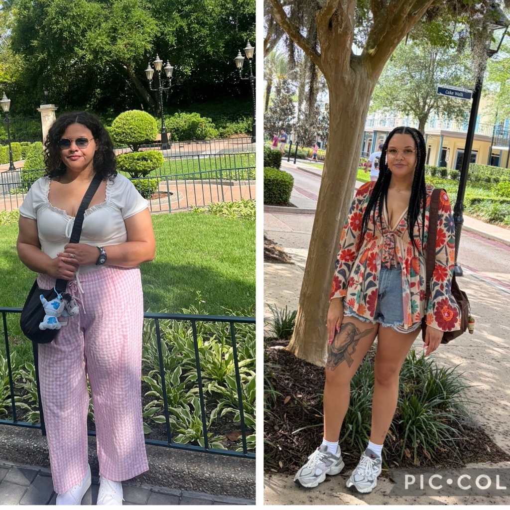 Patient before and after transformation – Radiant Health & Wellness