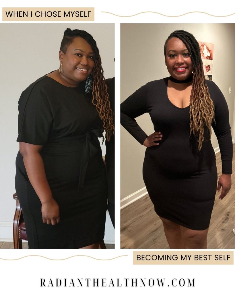 Before and after medical weight loss – Murfreesboro TN