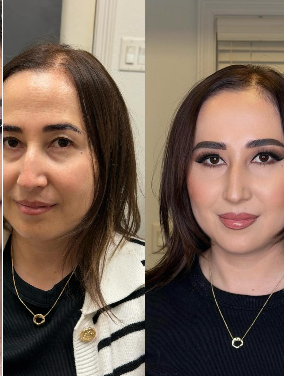 ZGlam result 2