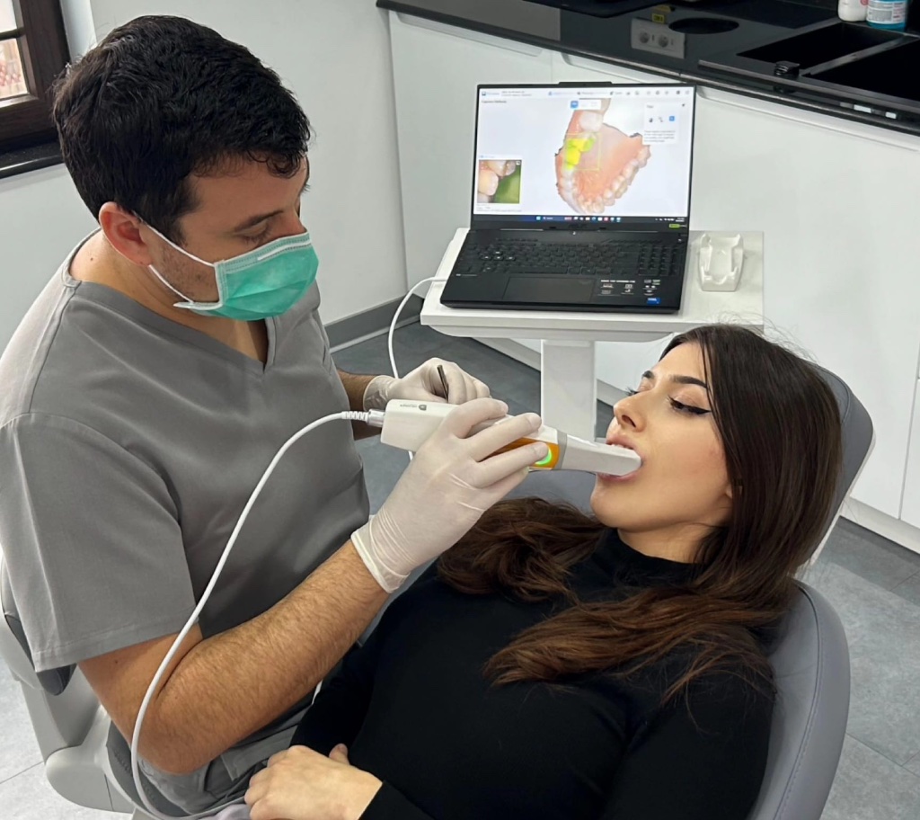 Scanare intraorală realizată cu scanner digital 3D în clinica stomatologică