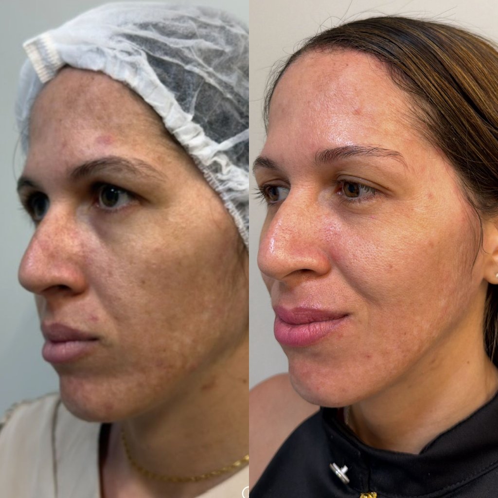 Gerenciamento de melasma