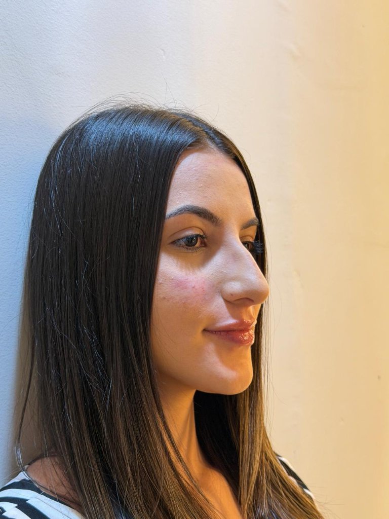 Tratamento facial
