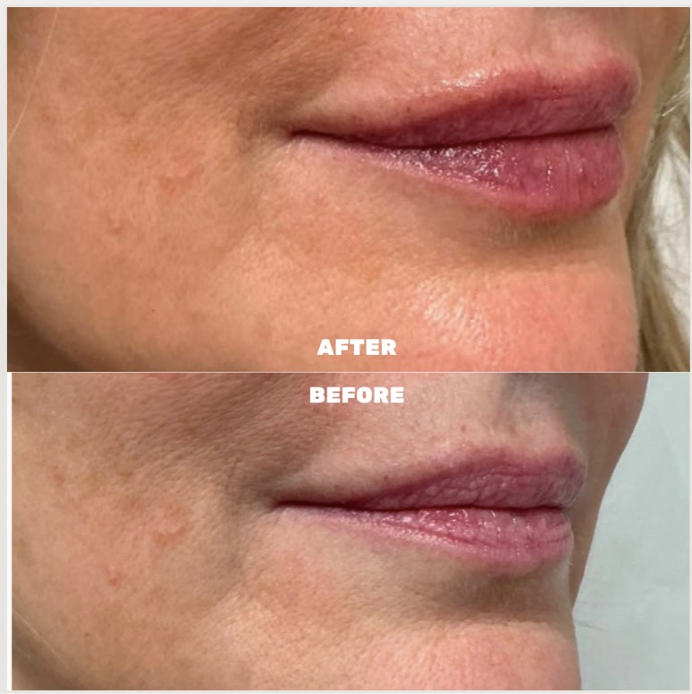 Before & After 18