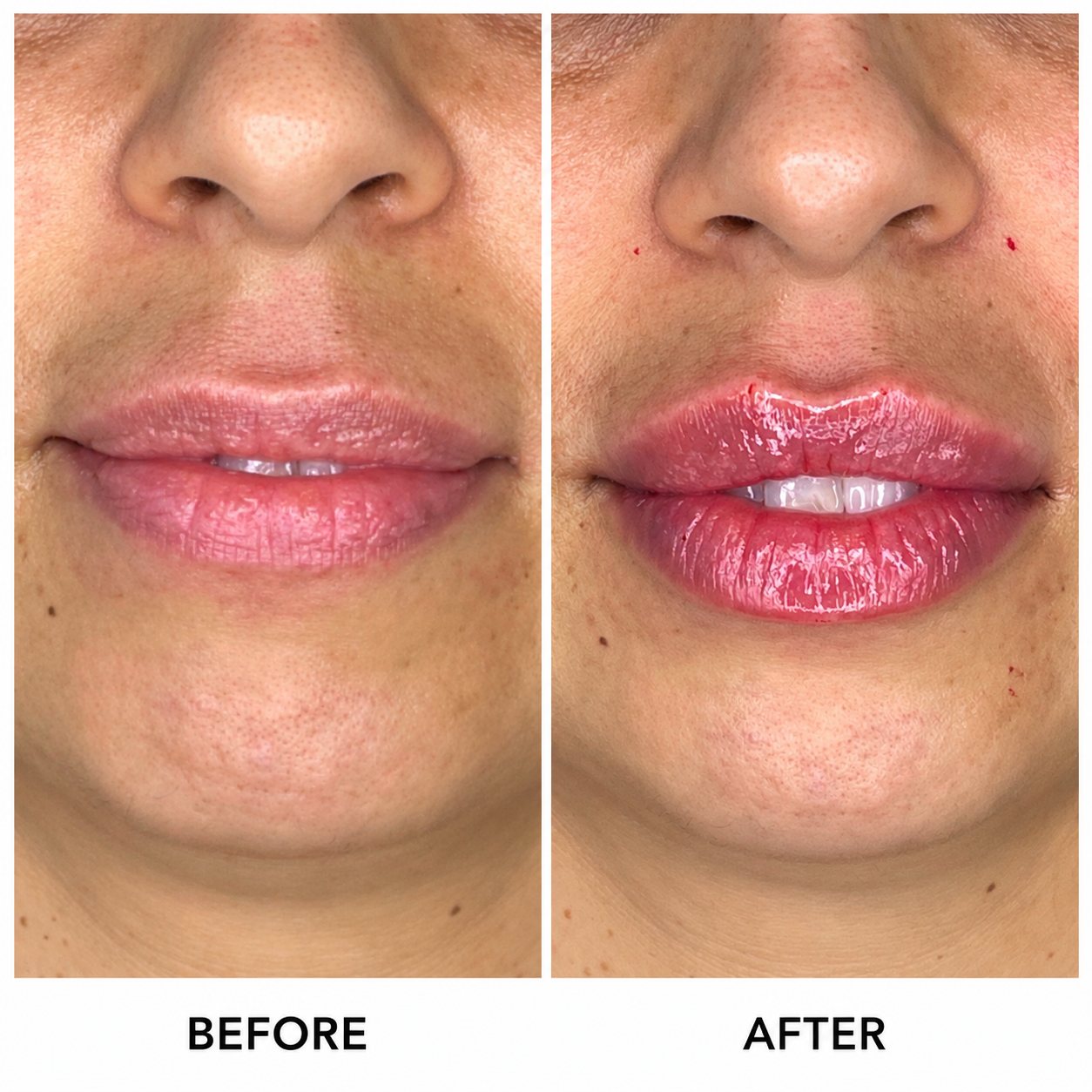 Before & After 6