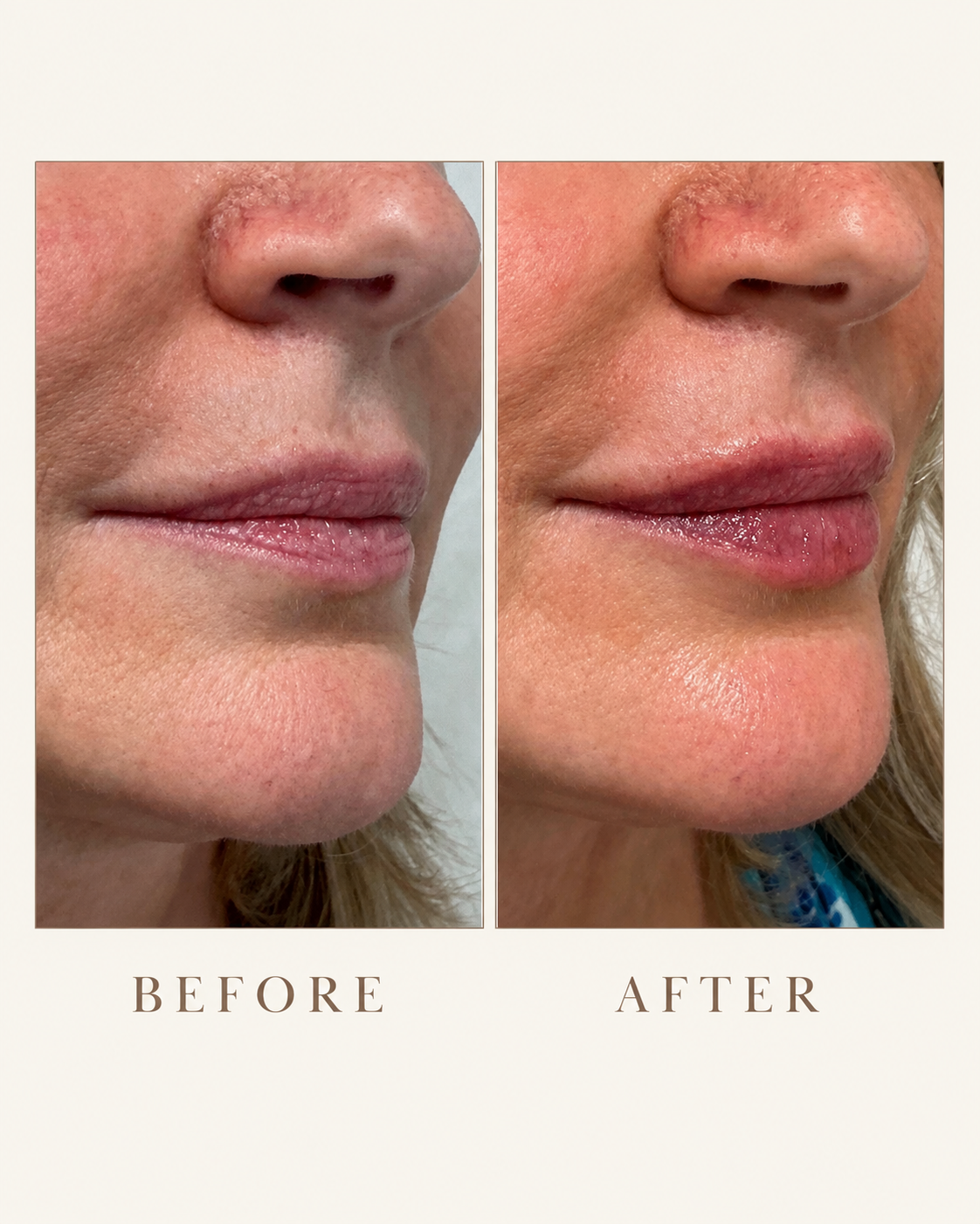 Before & After 15