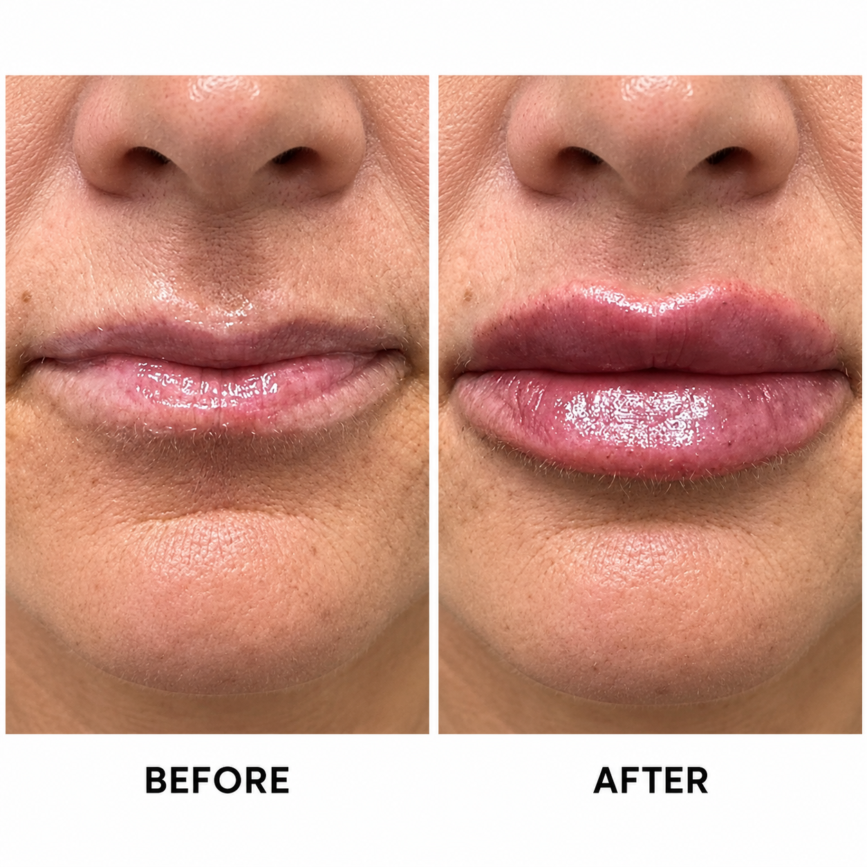 Before & After 4