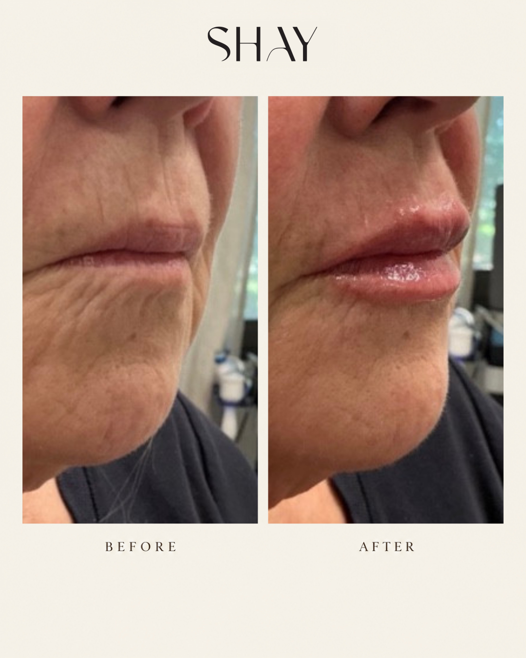 Before & After 13
