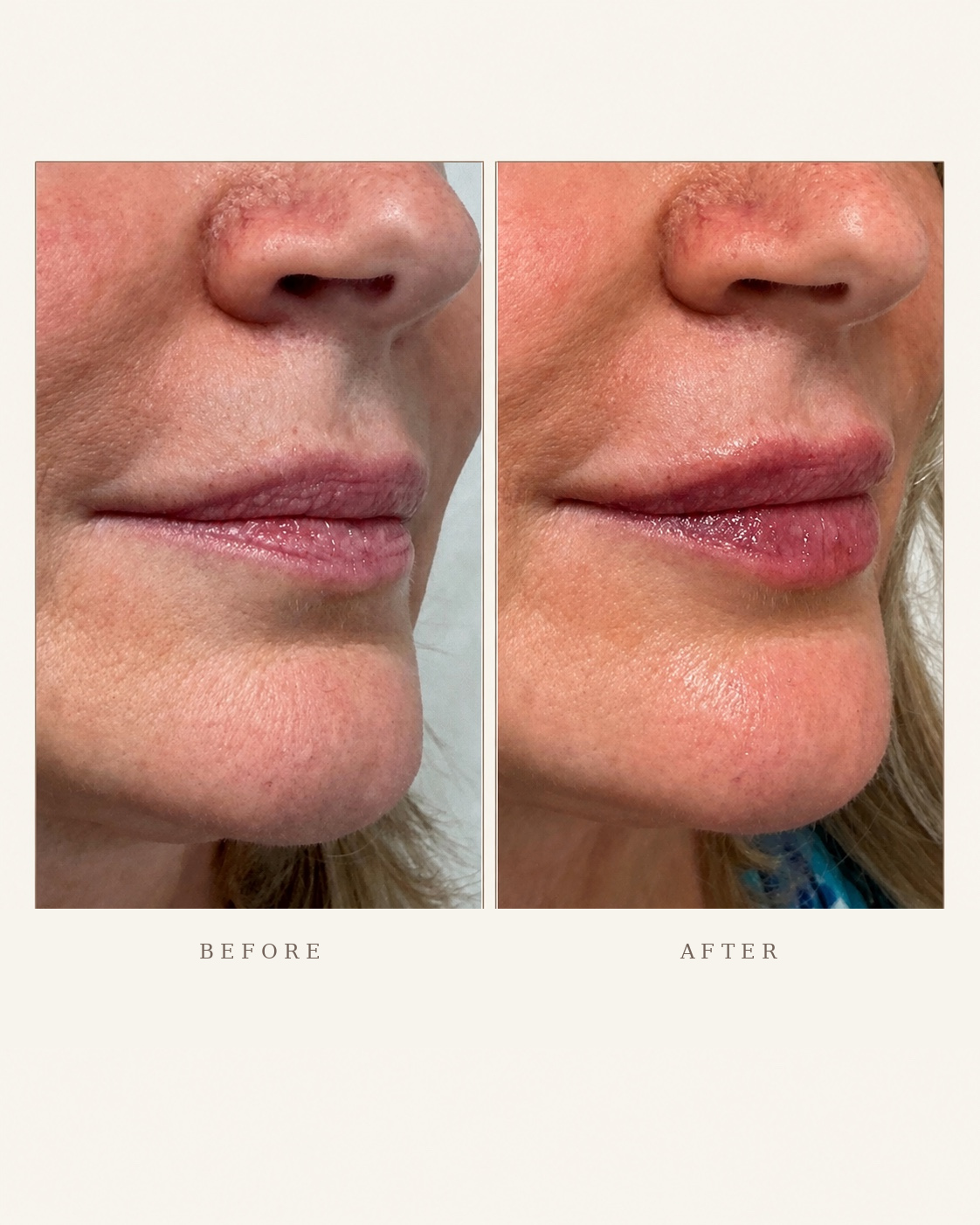 Before & After 14