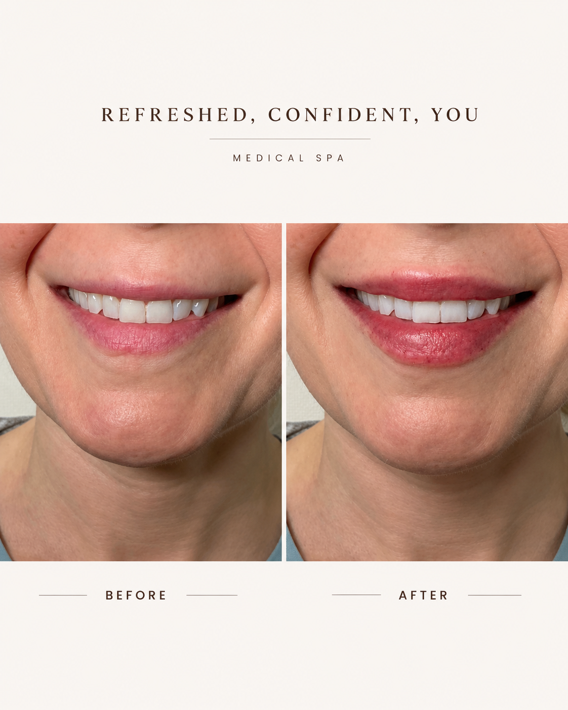 Before & After 17